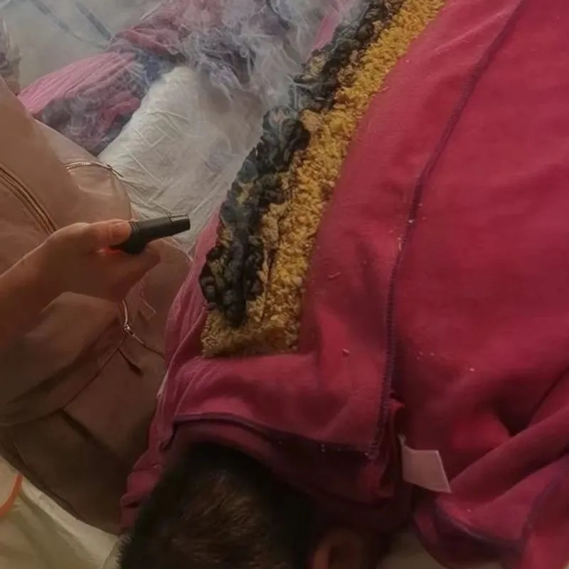 Ogenj Zmaj moksibustija